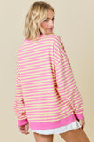 Dulce Oversized Striped Top